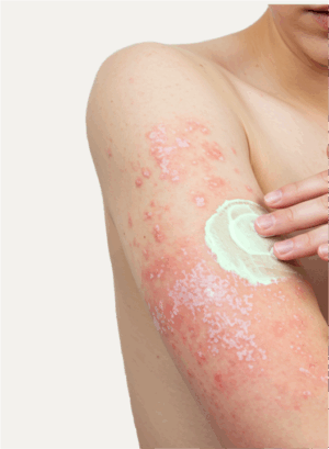AntiMicrobial Cream - Image 5