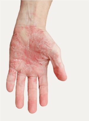 Skin Treat Ointment - Image 4